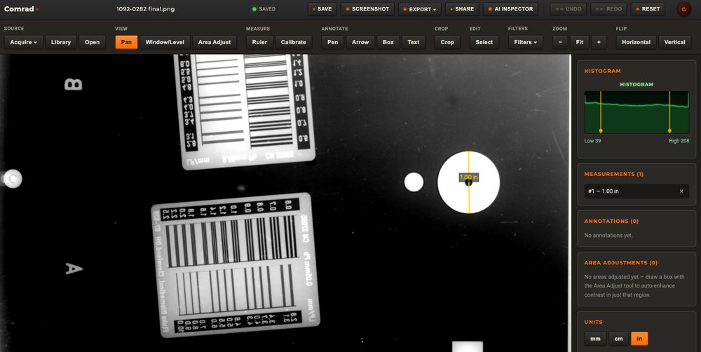 Lightbox image viewer showing a calibrated measurement and histogram on a CR scan